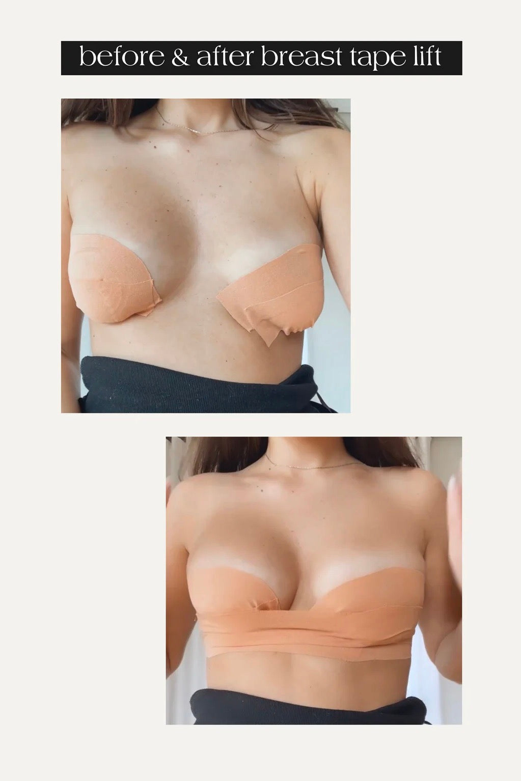 Using tape to clearance lift breasts